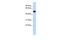 Translocation Associated Membrane Protein 1 Like 1 antibody, GTX45662, GeneTex, Western Blot image 