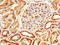 Serpin Family A Member 6 antibody, LS-C317800, Lifespan Biosciences, Immunohistochemistry paraffin image 