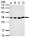 Translational Activator Of Cytochrome C Oxidase I antibody, GTX118757, GeneTex, Western Blot image 