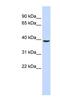 TRNA-YW Synthesizing Protein 5 antibody, NBP1-91416, Novus Biologicals, Western Blot image 