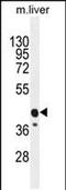 Calcium Voltage-Gated Channel Auxiliary Subunit Gamma 8 antibody, PA5-48249, Invitrogen Antibodies, Western Blot image 