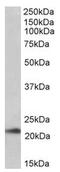 Transmembrane Protein 205 antibody, AP22430PU-N, Origene, Western Blot image 