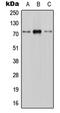 Solute Carrier Family 28 Member 1 antibody, MBS821038, MyBioSource, Western Blot image 