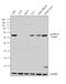 Aldehyde Dehydrogenase 1 Family Member A1 antibody, PA5-11537, Invitrogen Antibodies, Western Blot image 