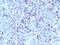 Glypican 3 antibody, NBP2-48397, Novus Biologicals, Immunohistochemistry paraffin image 