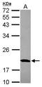 Mitochondrial Ribosomal Protein S10 antibody, GTX119522, GeneTex, Western Blot image 