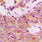 Ribosomal Protein S6 Kinase B1 antibody, LS-C354087, Lifespan Biosciences, Immunohistochemistry paraffin image 