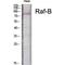 B-Raf Proto-Oncogene, Serine/Threonine Kinase antibody, LS-C385745, Lifespan Biosciences, Western Blot image 