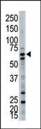 Ubiquilin 3 antibody, AP12099PU-N, Origene, Western Blot image 