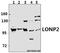 Lon Peptidase 2, Peroxisomal antibody, A11643-1, Boster Biological Technology, Western Blot image 
