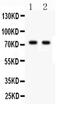 TNF Receptor Superfamily Member 1B antibody, PA5-80159, Invitrogen Antibodies, Western Blot image 