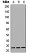 C-C Motif Chemokine Ligand 7 antibody, orb256344, Biorbyt, Western Blot image 