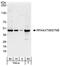 TWIST Neighbor antibody, A301-394A, Bethyl Labs, Western Blot image 