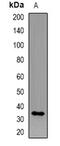 Killer Cell Immunoglobulin Like Receptor, Two Ig Domains And Short Cytoplasmic Tail 4 antibody, abx141304, Abbexa, Western Blot image 