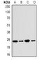 Proteasome Activator Subunit 2 antibody, orb340940, Biorbyt, Western Blot image 