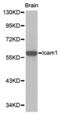 Intercellular Adhesion Molecule 1 antibody, abx000682, Abbexa, Western Blot image 