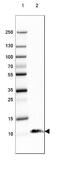 S100 Calcium Binding Protein B antibody, NBP2-46626, Novus Biologicals, Western Blot image 
