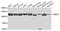 Ubiquitin Protein Ligase E3A antibody, A1757, ABclonal Technology, Western Blot image 