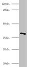 Subtilis Inositol 2-dehydrogenase/D-chiro-inositol 3-dehydrogenase  antibody, A54624-100, Epigentek, Western Blot image 