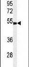 Gamma-Aminobutyric Acid Type A Receptor Gamma3 Subunit antibody, PA5-24729, Invitrogen Antibodies, Western Blot image 