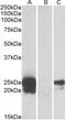 WAP Four-Disulfide Core Domain 2 antibody, MBS422349, MyBioSource, Western Blot image 