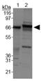 ATP Binding Cassette Subfamily F Member 2 antibody, GTX30469, GeneTex, Western Blot image 