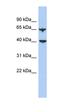 Apolipoprotein B MRNA Editing Enzyme Catalytic Polypeptide Like 4 antibody, orb330816, Biorbyt, Western Blot image 