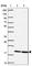 Galanin Like Peptide antibody, HPA053938, Atlas Antibodies, Western Blot image 