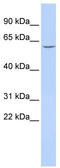 Carboxylesterase 5A antibody, TA339871, Origene, Western Blot image 