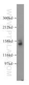 Stromal Antigen 1 antibody, 14015-1-AP, Proteintech Group, Western Blot image 