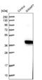 GTPase, IMAP Family Member 7 antibody, NBP1-81625, Novus Biologicals, Western Blot image 