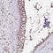 Kelch Like Family Member 11 antibody, PA5-62944, Invitrogen Antibodies, Immunohistochemistry frozen image 