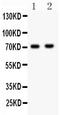 NUMB Endocytic Adaptor Protein antibody, PB9301, Boster Biological Technology, Western Blot image 