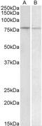 MAPK Activated Protein Kinase 2 antibody, 43-314, ProSci, Immunoprecipitation image 