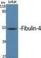 MAX Network Transcriptional Repressor antibody, A03357, Boster Biological Technology, Western Blot image 