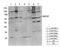 ATP Binding Cassette Subfamily B Member 7 antibody, STJ91411, St John