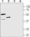 Arginine Vasopressin Receptor 1B antibody, PA5-77762, Invitrogen Antibodies, Western Blot image 