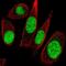 General Transcription Factor IIE Subunit 1 antibody, NBP2-58120, Novus Biologicals, Immunofluorescence image 