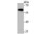 Cytochrome P450 19A1 antibody, NBP2-80415, Novus Biologicals, Western Blot image 