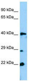 Gm13152 antibody, TA330614, Origene, Western Blot image 