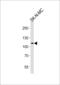 NOC3 Like DNA Replication Regulator antibody, LS-C162924, Lifespan Biosciences, Western Blot image 