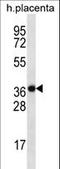 Solute Carrier Family 38 Member 8 antibody, LS-C161236, Lifespan Biosciences, Western Blot image 