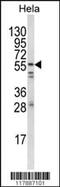 FYN Proto-Oncogene, Src Family Tyrosine Kinase antibody, MBS9212606, MyBioSource, Western Blot image 