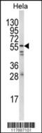 FYN Proto-Oncogene, Src Family Tyrosine Kinase antibody, MBS9212606, MyBioSource, Western Blot image 