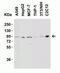 NPHS1 Adhesion Molecule, Nephrin antibody, NBP1-77303, Novus Biologicals, Western Blot image 