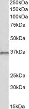 Homeobox C10 antibody, LS-B10576, Lifespan Biosciences, Western Blot image 