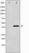 Protein Kinase AMP-Activated Non-Catalytic Subunit Beta 1 antibody, TA327899, Origene, Western Blot image 