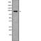 Elongator complex protein 2 antibody, abx146907, Abbexa, Western Blot image 