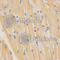Surfactant Protein C antibody, A1835, ABclonal Technology, Immunohistochemistry paraffin image 