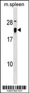 ALG13 UDP-N-Acetylglucosaminyltransferase Subunit antibody, 59-499, ProSci, Western Blot image 